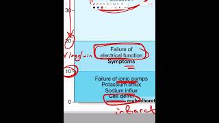 Ischemic Stroke  Part 3 [upl. by Kala]