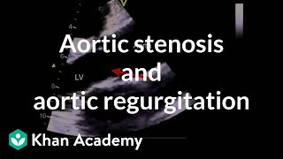 Aortic stenosis and aortic regurgitation  Circulatory System and Disease  NCLEXRN  Khan Academy [upl. by Aiuqcaj790]