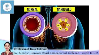 Acute bronchitis often referred to as a chest cold is an inflammation of the bronchial tubes [upl. by Aratal]