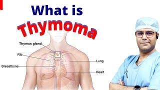 🔔 What is Thymoma Tumor Thymoma Cancer Symptoms shorts Thymoma ThymomaCancer [upl. by Crary]