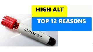 HIGH ALT LEVELS  TOP 12 REASONS [upl. by Abernon]