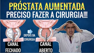 Quando você precisa fazer a cirurgia de PRÓSTATA AUMENTADA nem que não queira [upl. by Pinchas455]