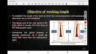 lec 5 endodontics root canal working length determination مرحلة رابعة طب أسنان [upl. by Ahsiekat755]