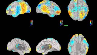 EEG source estimation  using the Brainstorm toolbox [upl. by Watkin563]