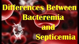 bacterial infection of blood complication of inflammation [upl. by Anilek]