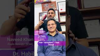 1Year FUE Hair Transplant Transformation 🌟  100 Natural Results  Dr Habibs Clinic 🏥 [upl. by Wunder]