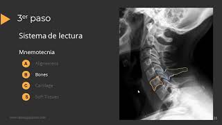 Radiografía de Columna Paso a Paso [upl. by Aillicec167]