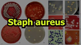 Staphylococcus aureus [upl. by Hayyifas]