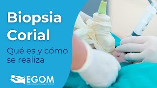 🧬 Biopsia corial  qué es en qué consiste y qué podemos detectar mediante esta prueba 🫃 [upl. by Partan]