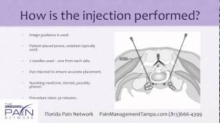 Superior Hypogastric Plexus Block at a Top Tampa Pain Clinic [upl. by Aivon]