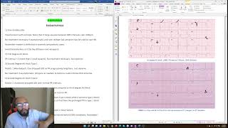 CK Cardiology  Arrhythmias  🫀 AVNRT AV Block and more [upl. by Ajdan]