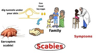 Scrabies Diagnosis Treatment Prevention [upl. by Nnywg]