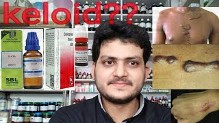 KeloidHomeopathic medicine for keloid explain [upl. by Lehmann]