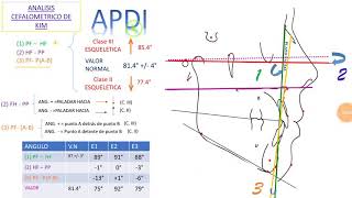 Cefalometria de kim  apdi [upl. by Ardnassela]
