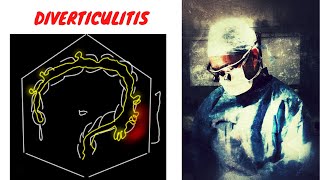 DIVERTICULITIS EXPLAINED [upl. by Aan]