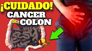 ¡TENE CUIDADO Estos SINTOMAS de ALARMA pueden ser CANCER de COLON CANCER de COLON PREVENCION [upl. by Eibrik]