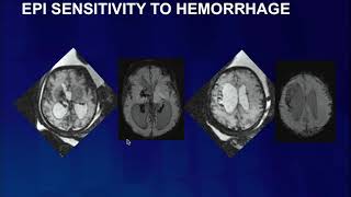 ISMRM MR Academy  Fetal MR imaging techniques A radiographers perspective on what you need to [upl. by Akiret]