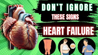 5 Signs to Heart Failure  DONT IGNORE [upl. by Owena]