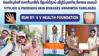 வெண்புள்ளி உள்ள நண்பர்கள் ஒன்று கூடும் முதல் நிகழ்ச்சி  Vitiligo Motivation Tamil [upl. by Ivad]