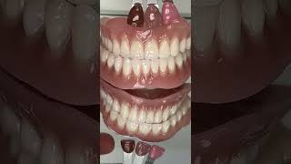 Find the Pink Colors for a Denture [upl. by Andras]