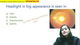 Mnemonic of the day  Fundus images Ophthalmology mnemonics Dr Nikita Nanwani [upl. by Alistair]