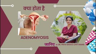 क्या होता है Adenomyosis जानिए Dr Priya Bhave Chittawar [upl. by Nyliac]