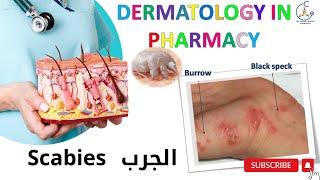 otc SCABIES DERMATOLOGY COURSE parasitic infestations Sarcoptes scabiei الجرب [upl. by Ogram105]