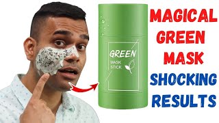 Does This Green Mask Stick Really Works   Green Mask Stick Honest Review  Dr Vivek Joshi [upl. by Olwen]