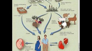 Congenital Toxoplasmosis [upl. by Atekihs]