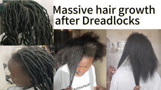 Removing artificial dreadlocks of 8 Months  Massive Hair Growth  Protect your hair  Best style [upl. by Noirred]