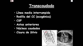 Ecografía del Sistema Nervioso Central fetal FACIL Parte 1 [upl. by Calabresi]