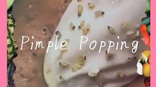 Pimple amp Blackheads Popping  48 [upl. by Dobrinsky644]