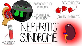 Understanding Nephritic Syndrome With Pathology Made Easy [upl. by Aninat159]