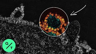 How the Coronavirus Hijacks Your Cells [upl. by Oicneserc869]