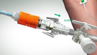 Chemfort®  Closed Administration using IV Safety Set Syringe Adaptor Lock and a Luer Lock Adaptor [upl. by Doreen]