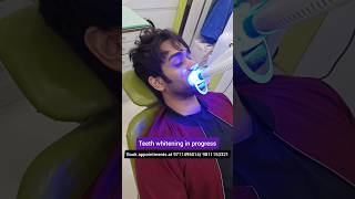 Get Amazing Teeth Whitening QUICK Dr Srishti Bhatia [upl. by Aneekan]