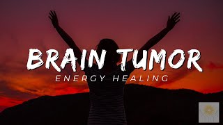 Brain Tumor Energy Healing  Healing at Hand [upl. by Welsh]