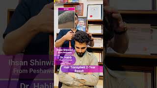 🌟 2Year Hair Transplant Transformation 😱 100 Natural Hairline  Dr Habib 🏥 hairtransplant [upl. by Myles]