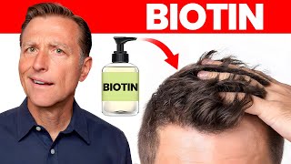 Does Biotin or Biotin Shampoo Really Work for Hair Loss [upl. by Englis125]