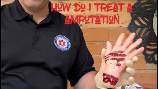 How to treat an amputation What do I do with an amputated body part [upl. by Suivatra]