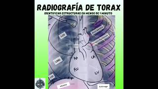 Elementos Radiografía Tórax en MENOS DE 1 MINUTO examenmir radiología [upl. by Kunin]