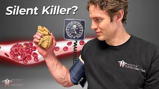 Why Blood Pressure is So Important amp How to Lower It [upl. by Aggappe]