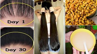 15 Days Challenge  Extreme Hair Growth  Worlds Best Faster Remedy for Hair Growth [upl. by Gavrilla440]