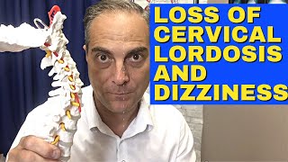 Ep24 Does Loss Of Lordosis Cause Dizziness And Vertigo Dr Walter Salubro Chiropractor in Vaughan [upl. by Iadam127]