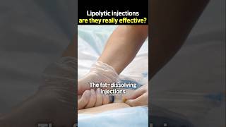 Lipolytic injections are they really effective [upl. by Minnnie]