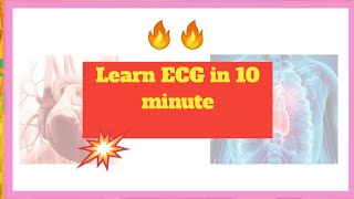 ECG learn ECG in 10 minute ECG interpretation ECG in Hindi [upl. by Everick]