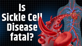 Why is it important to understand Sickle Cell Disease [upl. by Hudson]