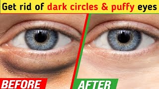 Only 6 mins Eye rejuvenation  Get rid of under eye wrinkles dark circles eye bags Crows feet [upl. by Ilojna]