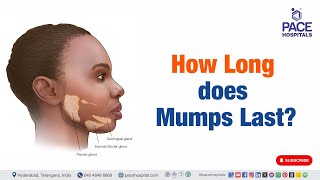 Mumps Last  How Long does Mumps Last  mumps shorts viralvideo [upl. by Lomax18]