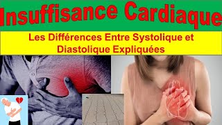 Insuffisance Cardiaque Congestive  Causes Symptômes et Traitements Avancés [upl. by Lseil189]